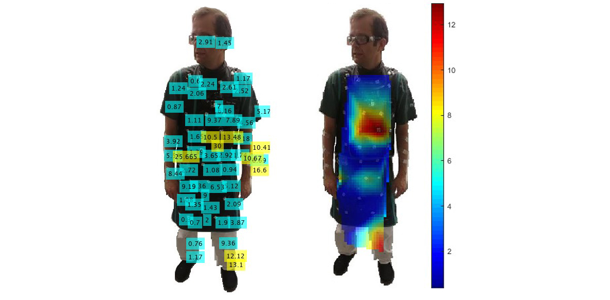 dose values dosimetre